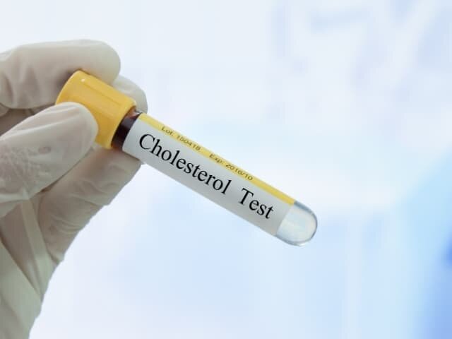 Test colesterolo-1_2